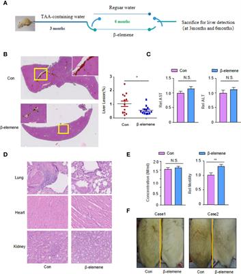 The Chemopreventive Role of β-Elemene in Cholangiocarcinoma by Restoring PCDH9 Expression